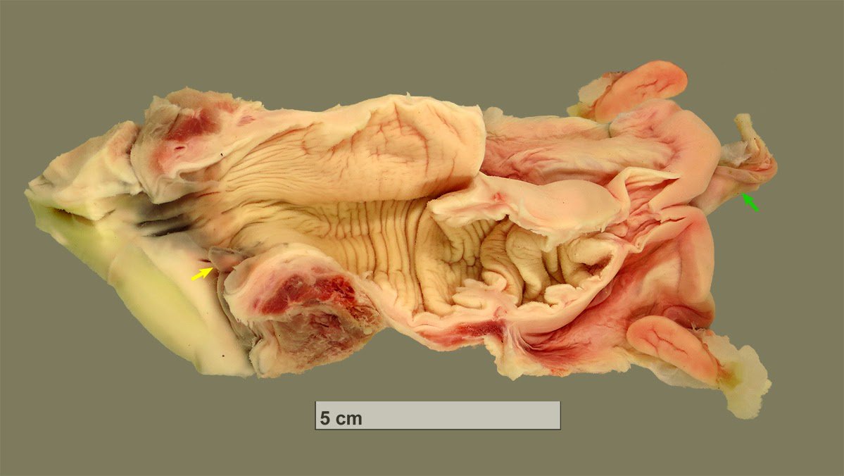 CB05094A7D59A8FA666E240D67BABA2D